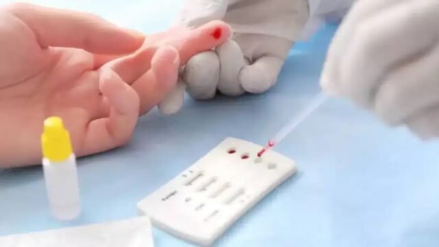 Anuncian jornada de salud con pruebas de VIH en Tapachula y seis municipios de Chiapas