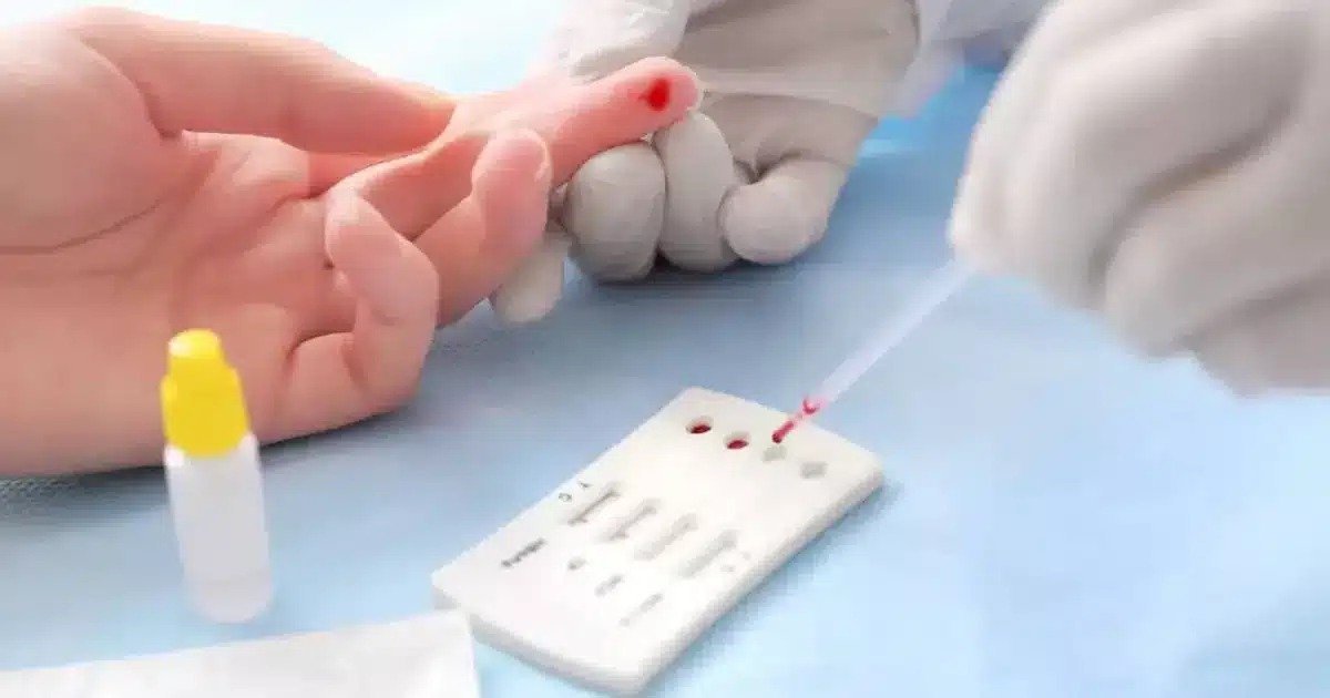 Anuncian jornada de salud con pruebas de VIH en Tapachula y seis municipios de Chiapas