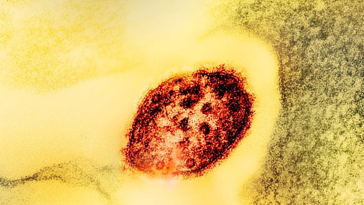 ¡Chiapas arde con sarampión: suma 7 de cada 10 casos nuevos del país!