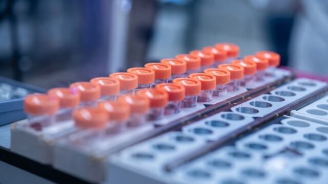 Frena al melanoma en ensayo global: vacuna de Moderna y Merck reduce 42% el riesgo