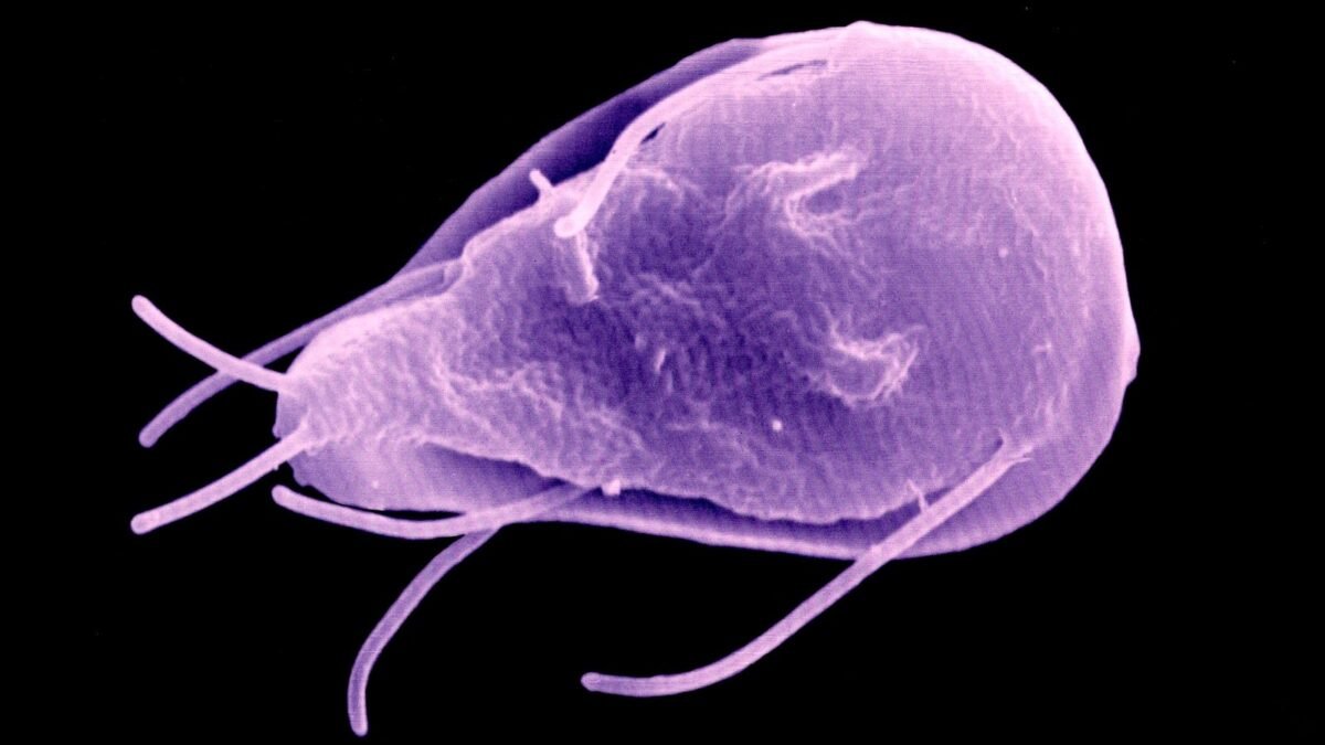 ¡Uno de cada cuatro con parásitos!: Giardia ataca a vecinos de Montecristo de Guerrero